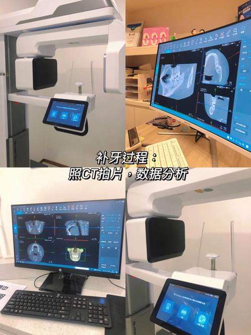 口腔健康与专业医疗服务 为何口腔护理和咨询缺一不可